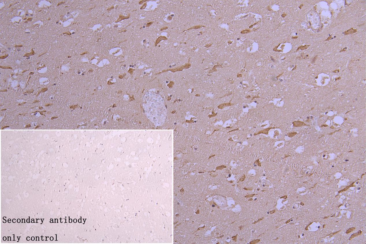CSB-RA827961A0HU