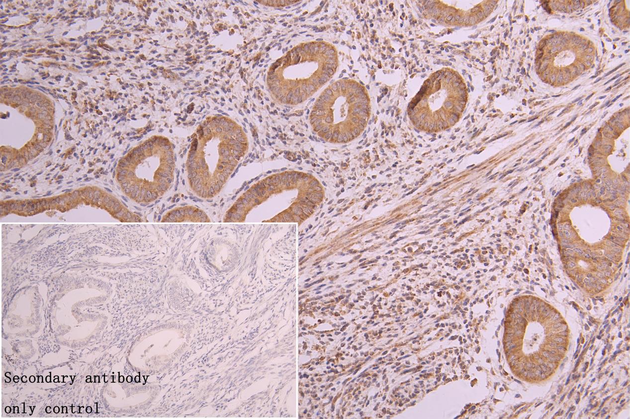 CSB-RA827961A0HU