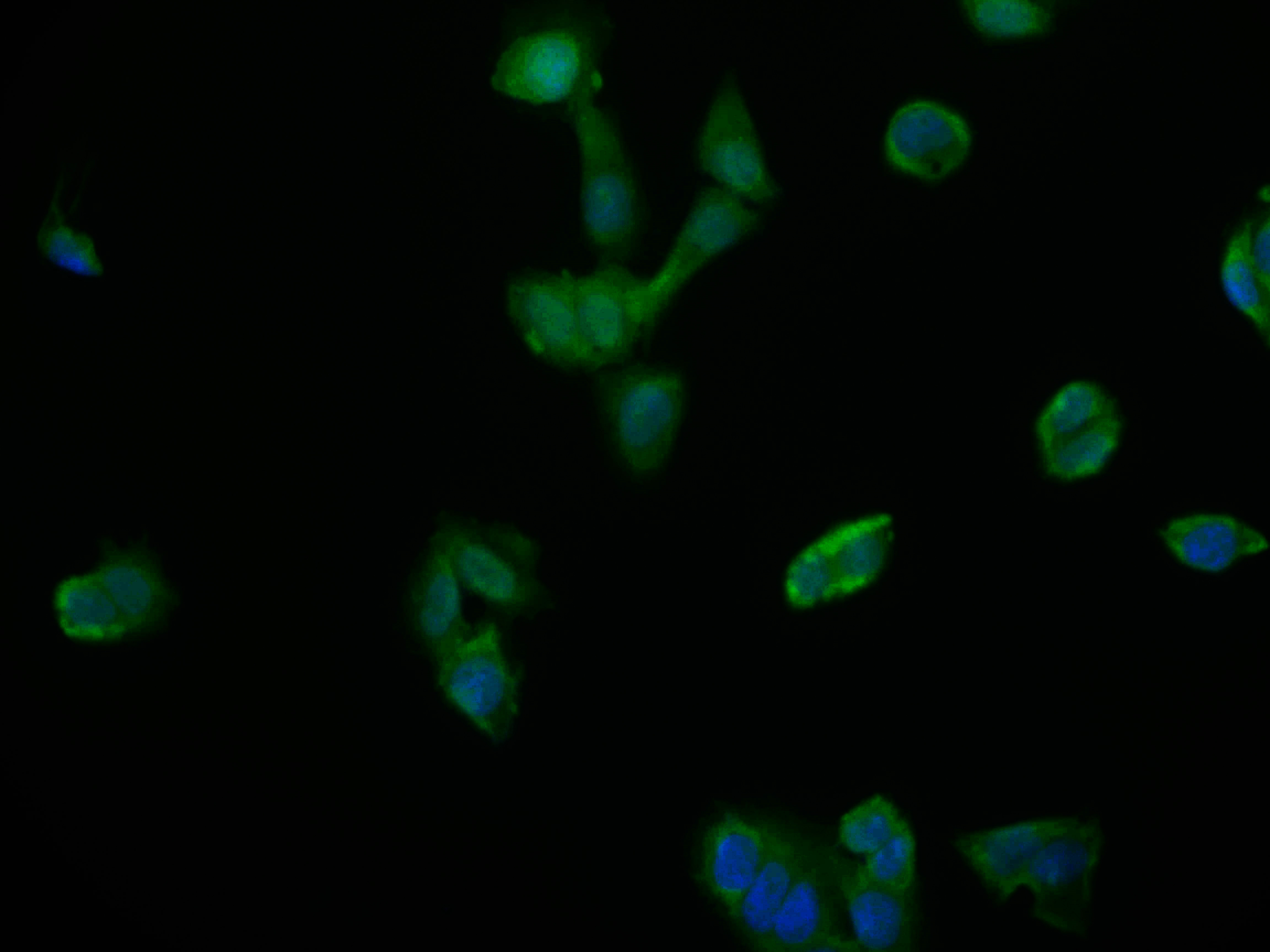 Immunofluorescence staining of PC-3 cell with CSB-RA832492A0HU at 1:50, counter-stained with DAPI. The cells were fixed in 4% formaldehyde and blocked in 10% normal Goat Serum. The cells were then incubated with the antibody overnight at 4°C. The secondary antibody was Alexa Fluor 604-congugated AffiniPure Goat Anti-Rabbit IgG(H+L).