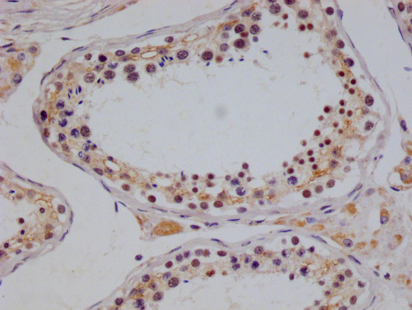 IHC image of CSB-RA832492A0HU diluted at 1:100 and staining in paraffin-embedded human testis tissue performed on a Leica BondTM system. After dewaxing and hydration, antigen retrieval was mediated by high pressure in a citrate buffer (pH 6.0). Section was blocked with 10% normal goat serum 30min at RT. Then primary antibody (1% BSA) was incubated at 4°C overnight. The primary is detected by a Goat anti-rabbit polymer IgG labeled by HRP and visualized using 0.05% DAB.