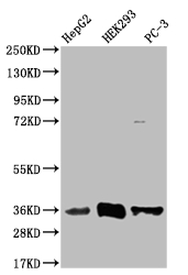 Western Blot Positive WB detected in: HepG2 whole cell lysate, HEK293 whole cell lysate, PC-3 whole cell lysate All lanes: NTHL1 antibody at 1:1000 Secondary Goat polyclonal to rabbit IgG at 1/50000 dilution Predicted band size: 35, 34, 33 kDa Observed band size: 35 kDa Western Blot Positive WB detected in: HepG2 whole cell lysate, HEK293 whole cell lysate, PC-3 whole cell lysate All lanes: NTHL1 antibody at 1:1000 Secondary Goat polyclonal to rabbit IgG at 1/50000 dilution Predicted band size: 35, 34, 33 kDa Observed band size: 35 kDa