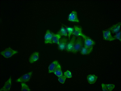 Immunofluorescence staining of Hela cells with CSB-RA835678A0HU at 1:23, counter-stained with DAPI. The cells were fixed in 4% formaldehyde, permeabilized using 0.2% Triton X-100 and blocked in 10% normal Goat Serum. The cells were then incubated with the antibody overnight at 4°C. The secondary antibody was Alexa Fluor 488-congugated AffiniPure Goat Anti-Rabbit IgG (H+L).