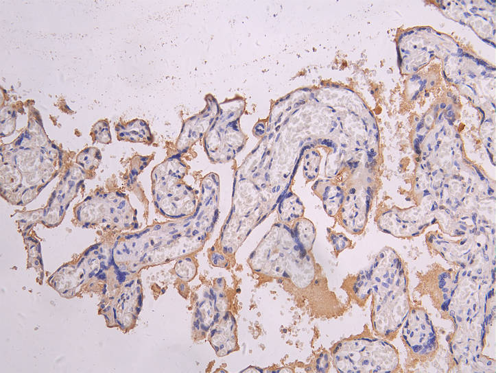 CSB-RA835695MA1HU