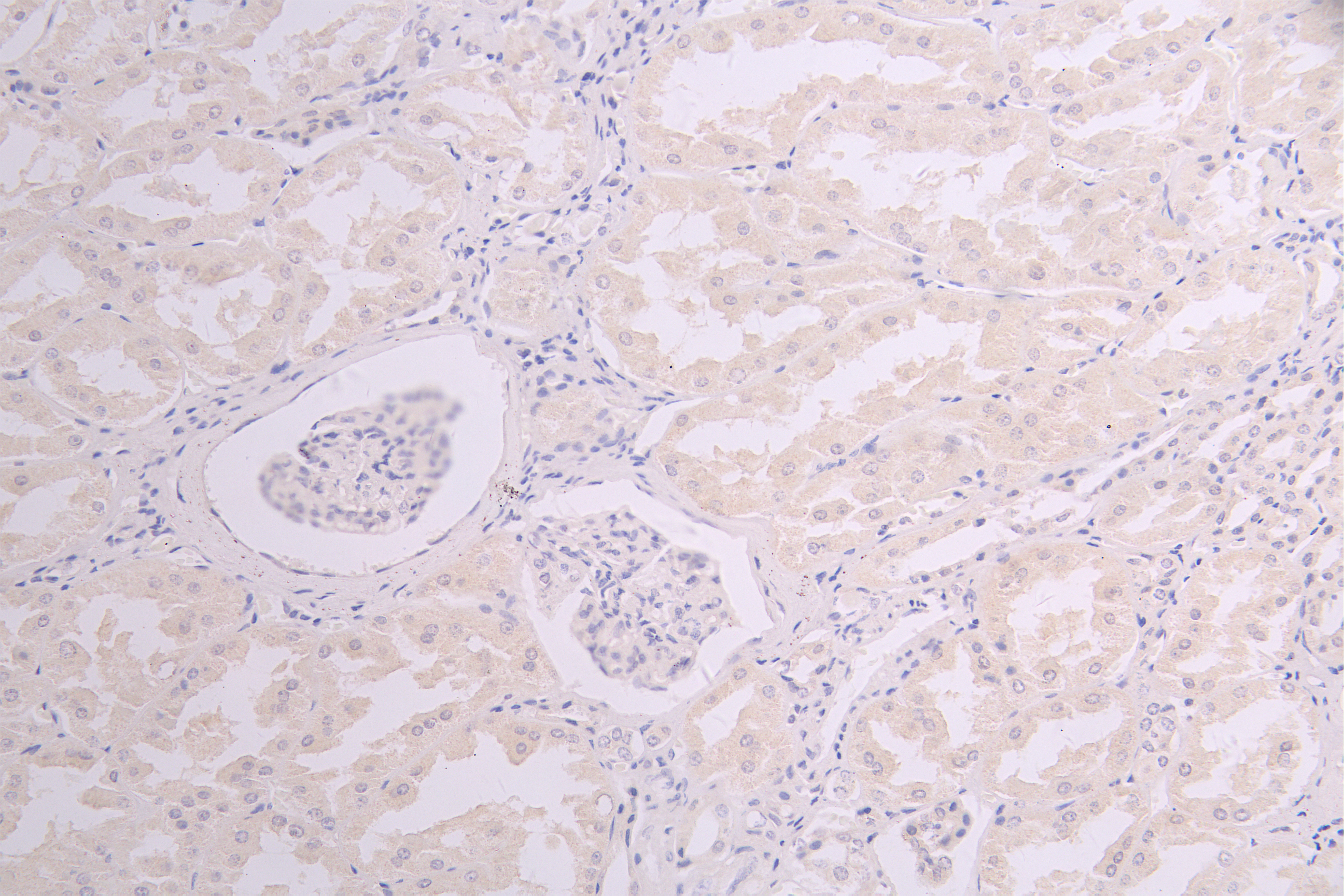 CSB-RA858415MA1HU