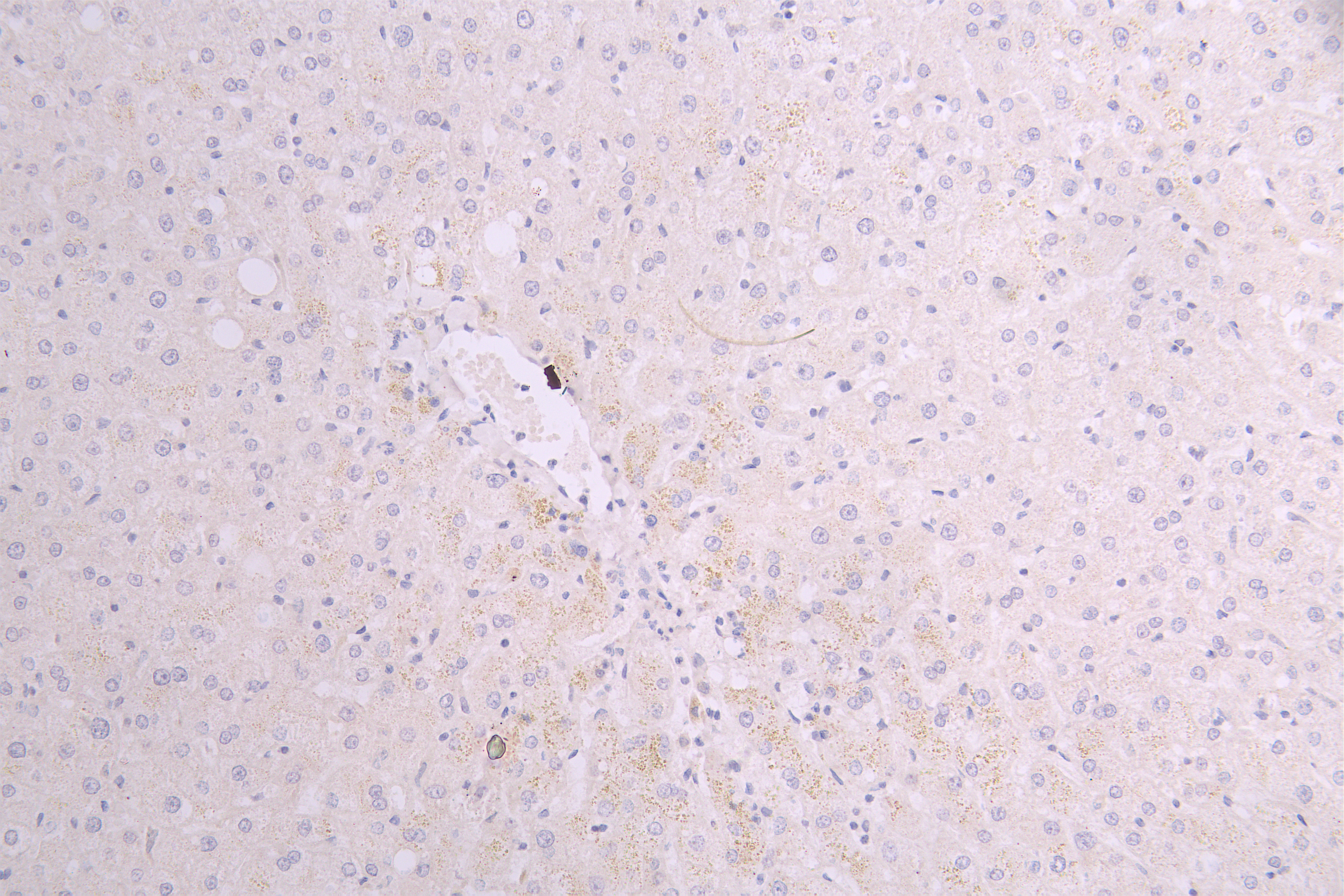 CSB-RA858415MA1HU