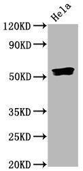 Western Blot Positive WB detected in Hela whole cell lysate All lanes Phospho-SMAD5 antibody at 0.835microg/ml Secondary Goat polyclonal to rabbit IgG at 1/50000 dilution Predicted band size: 52 KDa Observed band size: 52 KDa Western Blot Positive WB detected in Hela whole cell lysate All lanes Phospho-SMAD5 antibody at 0.835microg/ml Secondary Goat polyclonal to rabbit IgG at 1/50000 dilution Predicted band size: 52 KDa Observed band size: 52 KDa