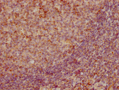 IHC image of CSB-RA859522A0HU diluted at 1:155 and staining in paraffin-embedded human tonsil tissue performed on a Leica BondTM system. After dewaxing and hydration, antigen retrieval was mediated by high pressure in a citrate buffer (pH 6.0). Section was blocked with 10% normal goat serum 30min at RT. Then primary antibody (1% BSA) was incubated at 4°C overnight. The primary is detected by a biotinylated secondary antibody and visualized using an HRP conjugated SP system. IHC image of CSB-RA859522A0HU diluted at 1:155 and staining in paraffin-embedded human tonsil tissue performed on a Leica BondTM system. After dewaxing and hydration, antigen retrieval was mediated by high pressure in a citrate buffer (pH 6.0). Section was blocked with 10% normal goat serum 30min at RT. Then primary antibody (1% BSA) was incubated at 4°C overnight. The primary is detected by a biotinylated secondary antibody and visualized using an HRP conjugated SP system.