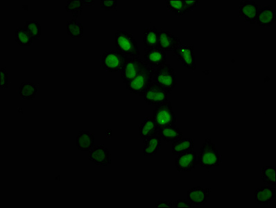Immunofluorescence staining of Hela cells with CSB-RA880154A0HU at 1:23, counter-stained with DAPI. The cells were fixed in 4% formaldehyde, permeabilized using 0.2% Triton X-100 and blocked in 10% normal Goat Serum. The cells were then incubated with the antibody overnight at 4°C. The secondary antibody was Alexa Fluor 488-congugated AffiniPure Goat Anti-Rabbit IgG (H+L).