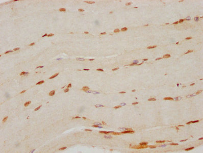 IHC image of CSB-RA880154A0HU diluted at 1:70 and staining in paraffin-embedded human skeletal muscle tissue performed on a Leica BondTM system. After dewaxing and hydration, antigen retrieval was mediated by high pressure in a citrate buffer (pH 6.0). Section was blocked with 10% normal goat serum 30min at RT. Then primary antibody (1% BSA) was incubated at 4°C overnight. The primary is detected by a biotinylated secondary antibody and visualized using an HRP conjugated SP system.