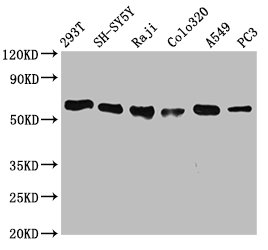 Western Blot Positive WB detected in: 293T whole cell lysate, SH-SY5Y whole cell lysate, Raji whole cell lysate, Colo320 whole cell lysate, A549 whole cell lysate, PC3 whole cell lysate All lanes: FTO antibody at 0.7microg/ml Secondary Goat polyclonal to rabbit IgG at 1/50000 dilution Predicted band size: 59, 15, 7, 13 KDa Observed band size: 59 KDa Western Blot Positive WB detected in: 293T whole cell lysate, SH-SY5Y whole cell lysate, Raji whole cell lysate, Colo320 whole cell lysate, A549 whole cell lysate, PC3 whole cell lysate All lanes: FTO antibody at 0.7microg/ml Secondary Goat polyclonal to rabbit IgG at 1/50000 dilution Predicted band size: 59, 15, 7, 13 KDa Observed band size: 59 KDa