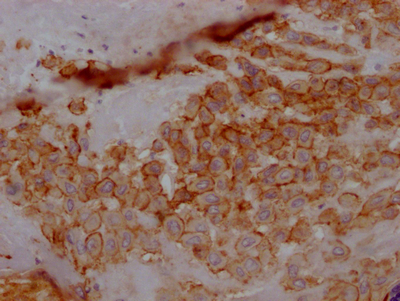 TPBG Recombinant Monoclonal Antibody - image 2
