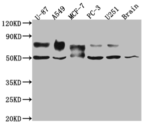 CSB-RA902876A0HU WB