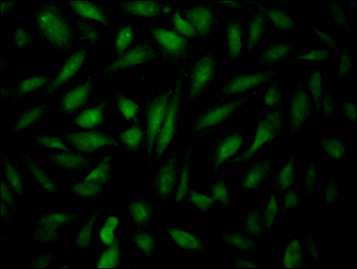 CSB-RA904931A0HU