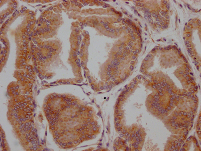 IHC image of CSB-RA907007A0HU diluted at 1:100 and staining in paraffin-embedded human prostate tissue performed on a Leica BondTM system. After dewaxing and hydration, antigen retrieval was mediated by high pressure in a citrate buffer (pH 6.0). Section was blocked with 10% normal goat serum 30min at RT. Then primary antibody (1% BSA) was incubated at 4°C overnight. The primary is detected by a Goat anti-rabbit IgG polymer labeled by HRP and visualized using 0.05% DAB.