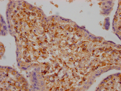 IHC image of CSB-RA907007A0HU diluted at 1:100 and staining in paraffin-embedded human placenta tissue performed on a Leica BondTM system. After dewaxing and hydration, antigen retrieval was mediated by high pressure in a citrate buffer (pH 6.0). Section was blocked with 10% normal goat serum 30min at RT. Then primary antibody (1% BSA) was incubated at 4°C overnight. The primary is detected by a Goat anti-rabbit IgG polymer labeled by HRP and visualized using 0.05% DAB.