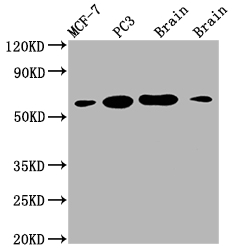Western Blot Positive WB detected in: MCF-7 whole cell lysate, PC3 whole cell lysate, Mouse brain tissue, Rat brain tissue All lanes: LOXL2 antibody at 1:2000 Secondary Goat polyclonal to rabbit IgG at 1/50000 dilution Predicted band size: 87 kDa Observed band size: 53 kDa Western Blot Positive WB detected in: MCF-7 whole cell lysate, PC3 whole cell lysate, Mouse brain tissue, Rat brain tissue All lanes: LOXL2 antibody at 1:2000 Secondary Goat polyclonal to rabbit IgG at 1/50000 dilution Predicted band size: 87 kDa Observed band size: 53 kDa
