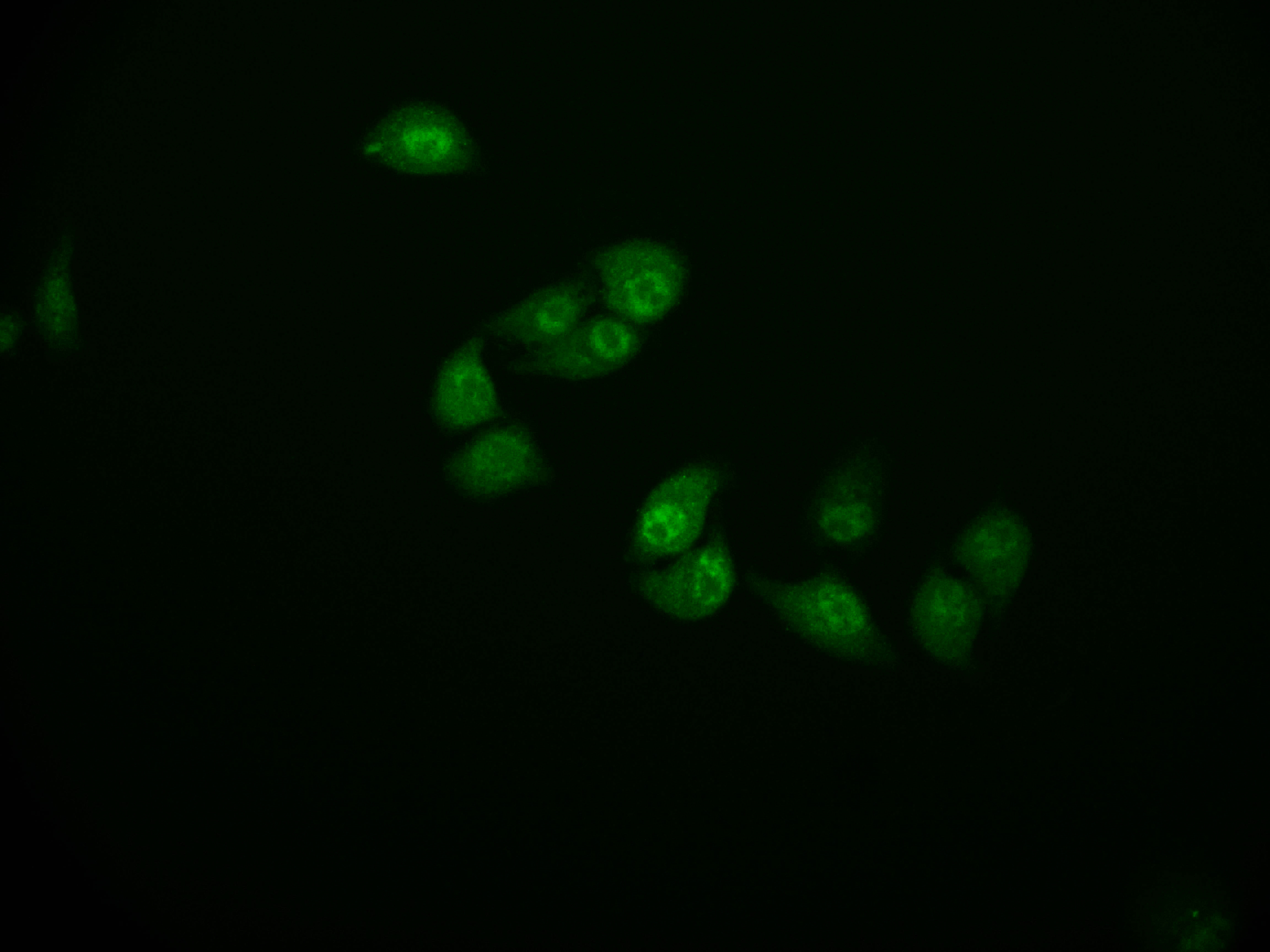 Immunofluorescence staining of Hela cell with CSB-RA914307A0HU at 1:50, counter-stained with DAPI. The cells were fixed in 4% formaldehyde and blocked in 10% normal Goat Serum. The cells were then incubated with the antibody overnight at 4°C. The secondary antibody was Alexa Fluor 591-congugated AffiniPure Goat Anti-Rabbit IgG(H+L). Immunofluorescence staining of Hela cell with CSB-RA914307A0HU at 1:50, counter-stained with DAPI. The cells were fixed in 4% formaldehyde and blocked in 10% normal Goat Serum. The cells were then incubated with the antibody overnight at 4°C. The secondary antibody was Alexa Fluor 591-congugated AffiniPure Goat Anti-Rabbit IgG(H+L).