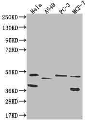 Western Blot Positive WB detected in: Hela whole cell lysate, A549 whole cell lysate, PC-3 whole cell lysate, MCF-7 whole cell lysate All lanes: PLEKHA1 antibody at 1:1000 Secondary Goat polyclonal to rabbit IgG at 1/50000 dilution Predicted band size: 46, 39 kDa Observed band size: 36-55 kDa Western Blot Positive WB detected in: Hela whole cell lysate, A549 whole cell lysate, PC-3 whole cell lysate, MCF-7 whole cell lysate All lanes: PLEKHA1 antibody at 1:1000 Secondary Goat polyclonal to rabbit IgG at 1/50000 dilution Predicted band size: 46, 39 kDa Observed band size: 36-55 kDa