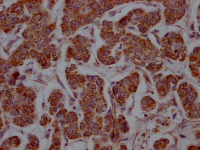SLC16A1 Recombinant Monoclonal Antibody - image 2