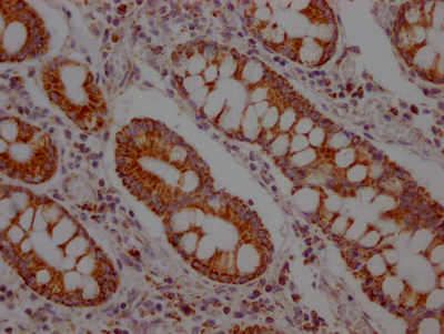 SLC16A1 Recombinant Monoclonal Antibody - image 3