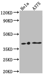 Western Blot Positive WB detected in: Hela whole cell lysate, A375 whole cell lysate All lanes: EDG2 antibody at 1:1000 Secondary Goat polyclonal to rabbit IgG at 1/50000 dilution Predicted band size: 42, 42 kDa Observed band size: 42 kDa Western Blot Positive WB detected in: Hela whole cell lysate, A375 whole cell lysate All lanes: EDG2 antibody at 1:1000 Secondary Goat polyclonal to rabbit IgG at 1/50000 dilution Predicted band size: 42, 42 kDa Observed band size: 42 kDa