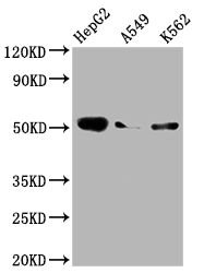 Western Blot Positive WB detected in: HepG2 whole cell lysate, A549 whole cell lysate, K562 whole cell lysate All lanes: Factor IX antibody at 1:2000 Secondary Goat polyclonal to rabbit IgG at 1/50000 dilution Predicted band size: 52 kDa Observed band size: 52 kDa Western Blot Positive WB detected in: HepG2 whole cell lysate, A549 whole cell lysate, K562 whole cell lysate All lanes: Factor IX antibody at 1:2000 Secondary Goat polyclonal to rabbit IgG at 1/50000 dilution Predicted band size: 52 kDa Observed band size: 52 kDa