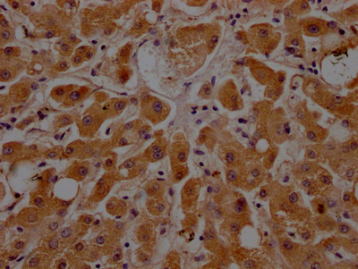 IHC image of CSB-RA925915A0HU diluted at 1:100 and staining in paraffin-embedded human liver tissue performed on a Leica BondTM system. After dewaxing and hydration, antigen retrieval was mediated by high pressure in a citrate buffer (pH 6.0). Section was blocked with 10% normal goat serum 30min at RT. Then primary antibody (1% BSA) was incubated at 4°C overnight. The primary is detected by a Goat anti-rabbit IgG polymer labeled by HRP and visualized using 0.05% DAB. IHC image of CSB-RA925915A0HU diluted at 1:100 and staining in paraffin-embedded human liver tissue performed on a Leica BondTM system. After dewaxing and hydration, antigen retrieval was mediated by high pressure in a citrate buffer (pH 6.0). Section was blocked with 10% normal goat serum 30min at RT. Then primary antibody (1% BSA) was incubated at 4°C overnight. The primary is detected by a Goat anti-rabbit IgG polymer labeled by HRP and visualized using 0.05% DAB.