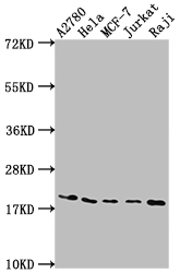 Western Blot Positive WB detected in: A2780 whole cell lysate, Hela whole cell lysate, MCF-7 whole cell lysate, Jurkat whole cell lysate, Raji whole cell lysate All lanes: EIF5A antibody at 1:2000 Secondary Goat polyclonal to rabbit IgG at 1/50000 dilution Predicted band size: 17, 21 kDa Observed band size: 18 kDa Western Blot Positive WB detected in: A2780 whole cell lysate, Hela whole cell lysate, MCF-7 whole cell lysate, Jurkat whole cell lysate, Raji whole cell lysate All lanes: EIF5A antibody at 1:2000 Secondary Goat polyclonal to rabbit IgG at 1/50000 dilution Predicted band size: 17, 21 kDa Observed band size: 18 kDa
