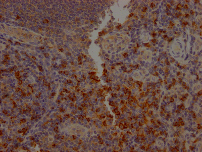 IHC image of CSB-RA934881A0HU diluted at 1:100 and staining in paraffin-embedded human tonsil tissue performed on a Leica BondTM system. After dewaxing and hydration, antigen retrieval was mediated by high pressure in a citrate buffer (pH 6.0). Section was blocked with 10% normal goat serum 30min at RT. Then primary antibody (1% BSA) was incubated at 4°C overnight. The primary is detected by a Goat anti-rabbit IgG polymer labeled by HRP and visualized using 0.05% DAB.