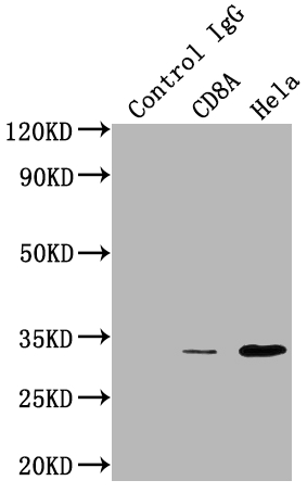 Immunoprecipitating CD8A in HepG2 whole cell lysate Lane 1: Rabbit control IgG instead of CSB-RA934881A0HU in HepG2 whole cell lysate. For western blotting,a HRP-conjugated Protein G antibody was used as the secondary antibody (1/2000) Lane 2:CSB-RA934881A0HU(3microg)+ HepG2 whole cell lysate(500microg) Lane 3: HepG2 whole cell lysate (10microg)