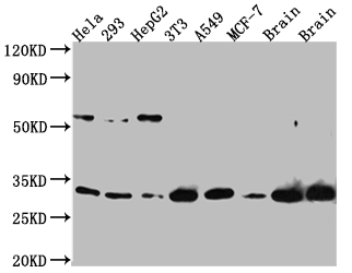 Western Blot Positive WB detected in: Hela whole cell lysate, 293 whole cell lysate, HepG2 whole cell lysate, NIH/3T3 whole cell lysate, A549 whole cell lysate, MCF-7 whole cell lysate, Mouse Brain whole cell lysate, Rat Brain whole cell lysate All lanes: PGAM1 Antibody at 1:1000 Secondary Goat polyclonal to rabbit IgG at 1/50000 dilution Predicted band size: 28 kDa Observed band size: 29 kDa