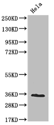 Western Blot Positive WB detected in: Hela whole cell lysate All lanes: NUDT5 antibody at 1:2000 Secondary Goat polyclonal to rabbit IgG at 1/50000 dilution Predicted band size: 25 kDa Observed band size: 36 kDa Western Blot Positive WB detected in: Hela whole cell lysate All lanes: NUDT5 antibody at 1:2000 Secondary Goat polyclonal to rabbit IgG at 1/50000 dilution Predicted band size: 25 kDa Observed band size: 36 kDa