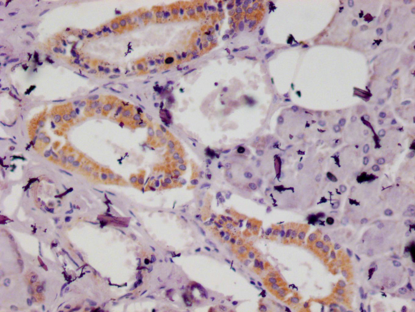 IHC image of CSB-RA937491A0HU diluted at 1:100 and staining in paraffin-embedded human salivary gland tissue performed on a Leica BondTM system. After dewaxing and hydration, antigen retrieval was mediated by high pressure in a citrate buffer (pH 6.0). Section was blocked with 10% normal goat serum 30min at RT. Then primary antibody (1% BSA) was incubated at 4°C overnight. The primary is detected by a Goat anti-rabbit polymer IgG labeled by HRP and visualized using 0.05% DAB. IHC image of CSB-RA937491A0HU diluted at 1:100 and staining in paraffin-embedded human salivary gland tissue performed on a Leica BondTM system. After dewaxing and hydration, antigen retrieval was mediated by high pressure in a citrate buffer (pH 6.0). Section was blocked with 10% normal goat serum 30min at RT. Then primary antibody (1% BSA) was incubated at 4°C overnight. The primary is detected by a Goat anti-rabbit polymer IgG labeled by HRP and visualized using 0.05% DAB.