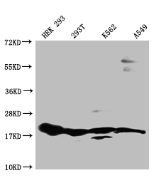 Western Blot Positive WB detected in: HEK293 whole cell lysate, 293T whole cell lysate, K562 whole cell lysate, A549 whole cell lysate All lanes: RPS19 antibody at 1:1000 Secondary Goat polyclonal to rabbit IgG at 1/50000 dilution Predicted band size: 17 kDa Observed band size: 15-20 kDa Western Blot Positive WB detected in: HEK293 whole cell lysate, 293T whole cell lysate, K562 whole cell lysate, A549 whole cell lysate All lanes: RPS19 antibody at 1:1000 Secondary Goat polyclonal to rabbit IgG at 1/50000 dilution Predicted band size: 17 kDa Observed band size: 15-20 kDa