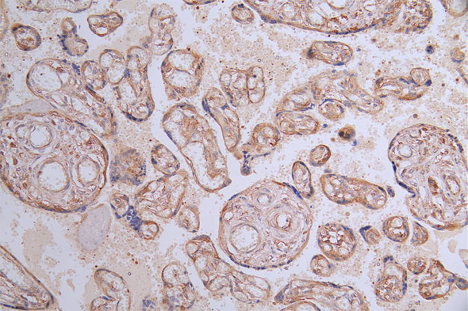 FLT1 Recombinant Monoclonal Antibody - image 2