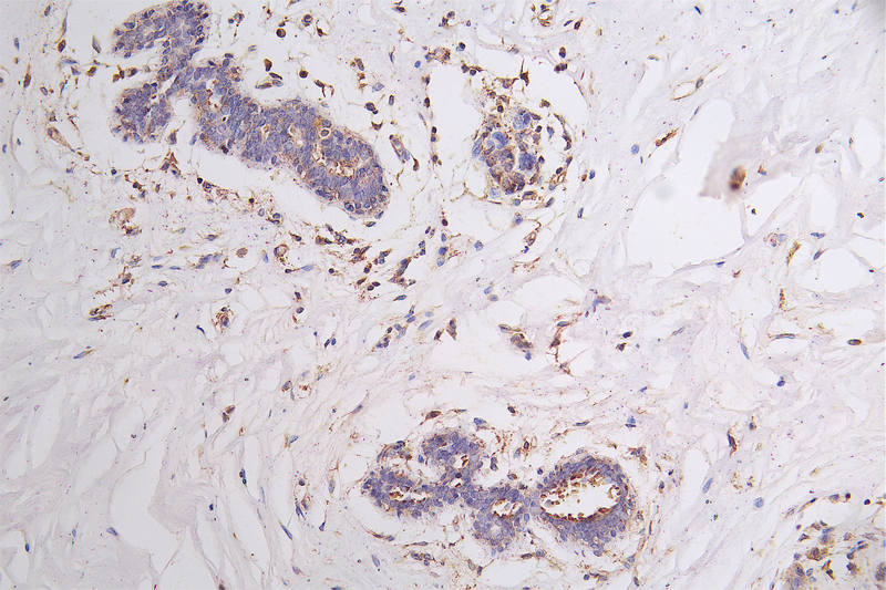 FLT1 Recombinant Monoclonal Antibody - image 3