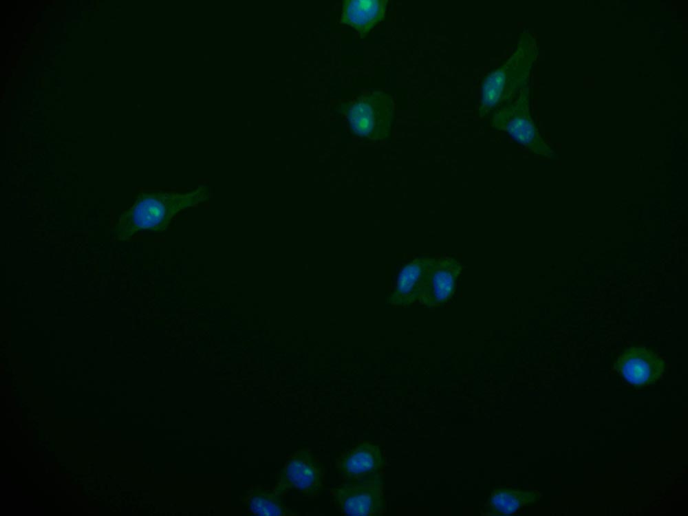 Immunofluorescence staining of HepG2 cell with CSB-RA943230A0HU at 1:50, counter-stained with DAPI. The cells were fixed in 4% formaldehyde and blocked in 10% normal Goat Serum. The cells were then incubated with the antibody overnight at 4°C. The secondary antibody was Alexa Fluor 518-congugated AffiniPure Goat Anti-Rabbit IgG(H+L).