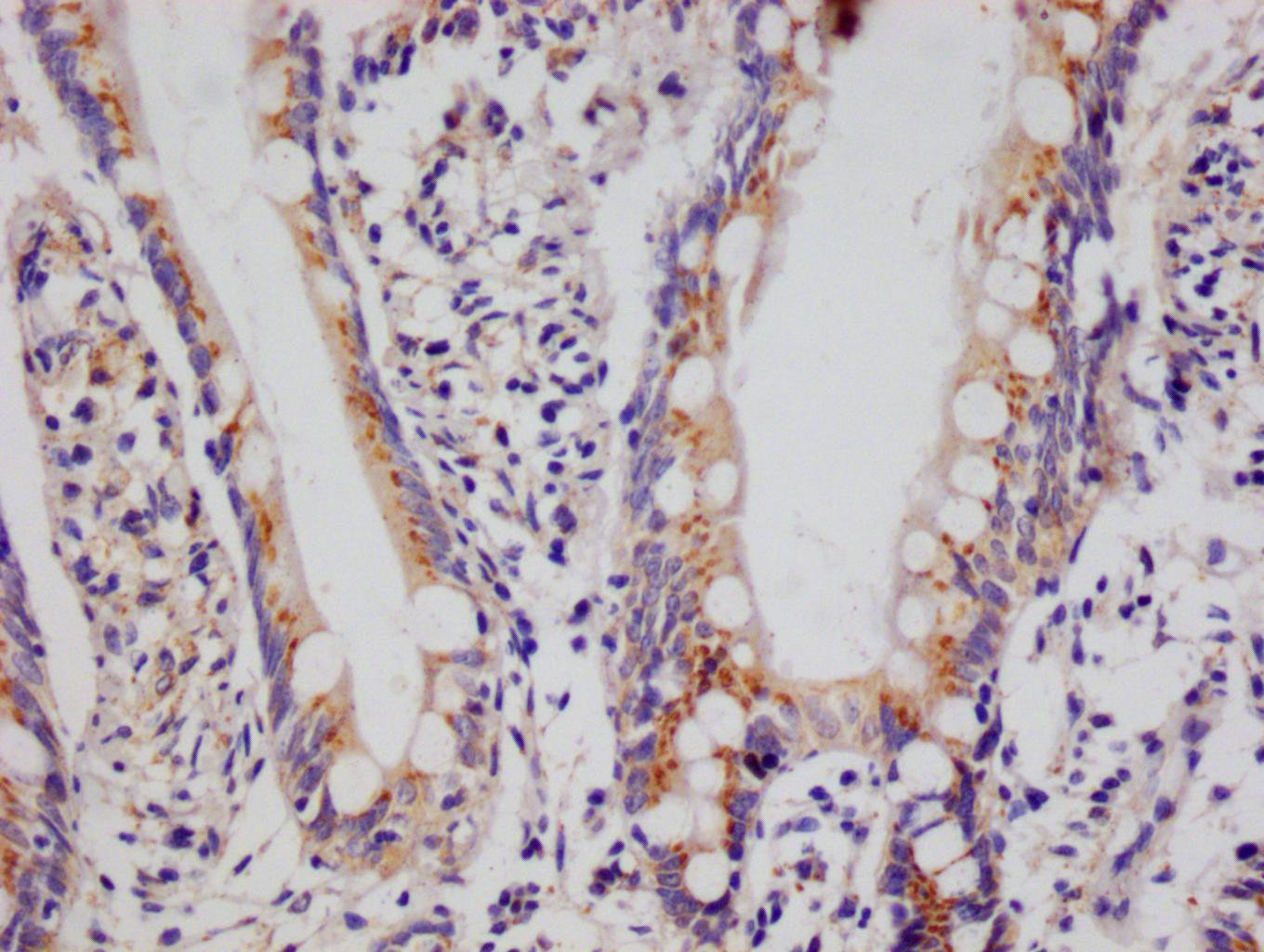 IHC image of CSB-RA943230A0HU diluted at 1:100 and staining in paraffin-embedded human small intestine tissue performed on a Leica BondTM system. After dewaxing and hydration, antigen retrieval was mediated by high pressure in a citrate buffer (pH 6.0). Section was blocked with 10% normal goat serum 30min at RT. Then primary antibody (1% BSA) was incubated at 4°C overnight. The primary is detected by a Goat anti-rabbit polymer IgG labeled by HRP and visualized using 0.05% DAB.