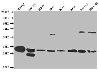 Western Blot Positive WB detected in: Jurkat whole cell lysate, HepG2 whole cell lysate, MCF-7 whole cell lysate, A549 whole cell lysate, PC3 whole cell lysate, Hela whole cell lysate, Ntera-2 whole cell lysate, U251 whole cell lysate All lanes: PSME1 antibody at 1:2000 Secondary Goat polyclonal to rabbit IgG at 1/50000 dilution Predicted band size: 29, 27 kDa Observed band size: 28-30, 55-72 kDa Western Blot Positive WB detected in: Jurkat whole cell lysate, HepG2 whole cell lysate, MCF-7 whole cell lysate, A549 whole cell lysate, PC3 whole cell lysate, Hela whole cell lysate, Ntera-2 whole cell lysate, U251 whole cell lysate All lanes: PSME1 antibody at 1:2000 Secondary Goat polyclonal to rabbit IgG at 1/50000 dilution Predicted band size: 29, 27 kDa Observed band size: 28-30, 55-72 kDa