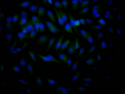HDAC2 Recombinant Monoclonal Antibody - image 4