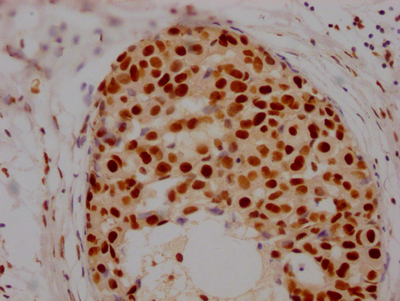 HDAC2 Recombinant Monoclonal Antibody - image 2