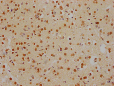HDAC2 Recombinant Monoclonal Antibody - image 3