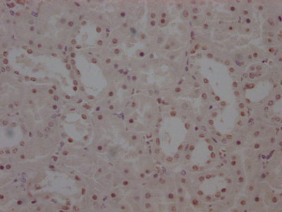 CSB-RA950156A0HU