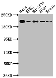 Western Blot Positive WB detected in: Hela whole cell lysate, K562 whole cell lysate, SH-SY5Y whole cell lysate, A549 whole cell lysate, Rat Brain whole cell lysate All lanes: APC antibody at 1:1000 Secondary Goat polyclonal to rabbit IgG at 1/50000 dilution Predicted band size: 312, 301, 309 kDa Observed band size: 160 kDa Western Blot Positive WB detected in: Hela whole cell lysate, K562 whole cell lysate, SH-SY5Y whole cell lysate, A549 whole cell lysate, Rat Brain whole cell lysate All lanes: APC antibody at 1:1000 Secondary Goat polyclonal to rabbit IgG at 1/50000 dilution Predicted band size: 312, 301, 309 kDa Observed band size: 160 kDa