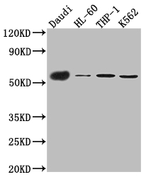 CSB-RA953976A0HU WB