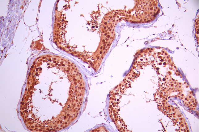 CSB-RA954261A0HU