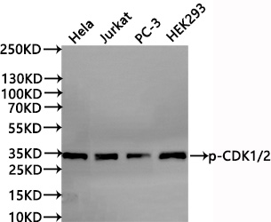 CSB-RA954261A0HU