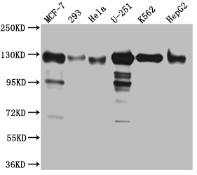 Western Blot Positive WB detected in: MCF-7 whole cell lysate, 293 whole cell lysate, Hela whole cell lysate, U-251 whole cell lysate, K562 whole cell lysate, HepG2 whole cell lysat All lanes: Eg5 Antibody at 1:1000 Secondary Goat polyclonal to rabbit IgG at 1/50000 dilution Predicted band size: 120 kDa Observed band size: 130 kDa Western Blot Positive WB detected in: MCF-7 whole cell lysate, 293 whole cell lysate, Hela whole cell lysate, U-251 whole cell lysate, K562 whole cell lysate, HepG2 whole cell lysat All lanes: Eg5 Antibody at 1:1000 Secondary Goat polyclonal to rabbit IgG at 1/50000 dilution Predicted band size: 120 kDa Observed band size: 130 kDa