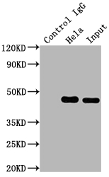 CSB-RA957619A0HU-IP