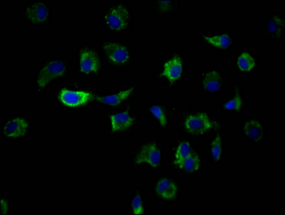Immunofluorescence staining of MCF7 Cells with CSB-RA963626A0HU at 1:50, counter-stained with DAPI. The cells were fixed in 4% formaldehyde and blocked in 10% normal Goat Serum. The cells were then incubated with the antibody overnight at 4°C. Nuclear DNA was labeled in blue with DAPI. The secondary antibody was FITC-conjugated AffiniPure Goat Anti-Rabbit IgG (H+L).